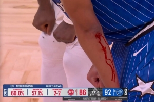 真拼命了！贝恩在等待罚球时 左手臂有磕碰&鲜血直流！